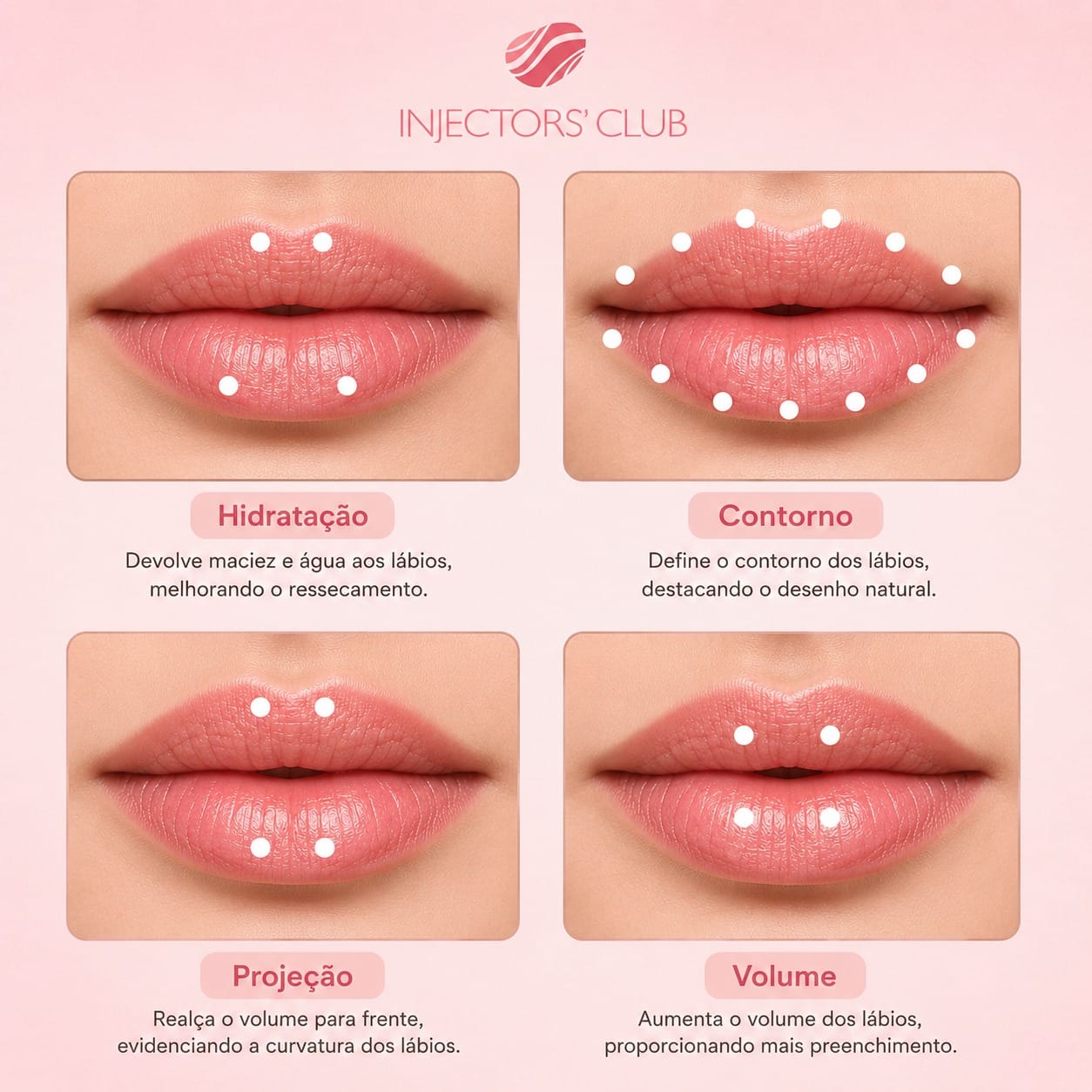  preenchimento de lábios em São Paulo: hidratação, contorno, projeção e volume