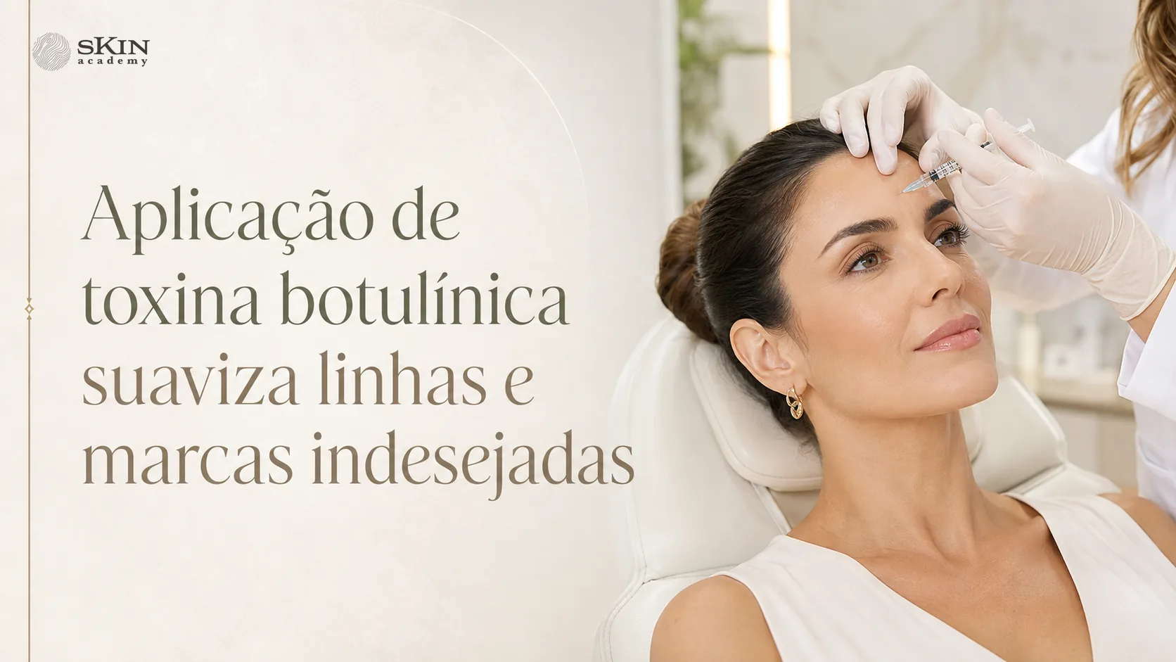 Dysport equivale a quantas unidades de Botox?